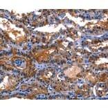 Immunohistochemistry - LGALS8 Antibody from Signalway Antibody (35748) - Antibodies.com