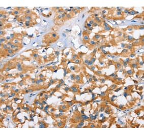 Immunohistochemistry - CXCL14 Antibody from Signalway Antibody (35752) - Antibodies.com