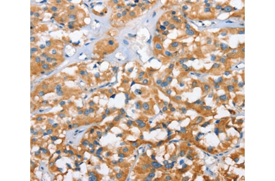 Immunohistochemistry - CXCL14 Antibody from Signalway Antibody (35752) - Antibodies.com