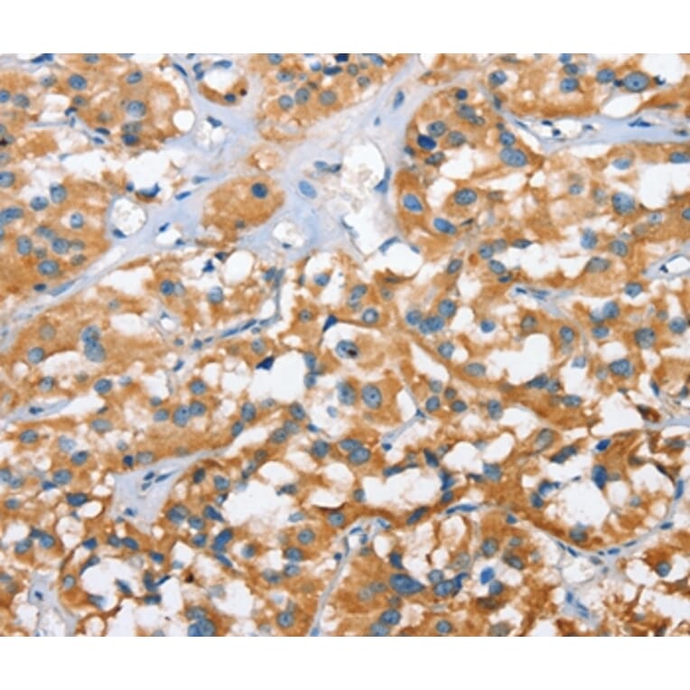 Immunohistochemistry - CXCL14 Antibody from Signalway Antibody (35752) - Antibodies.com