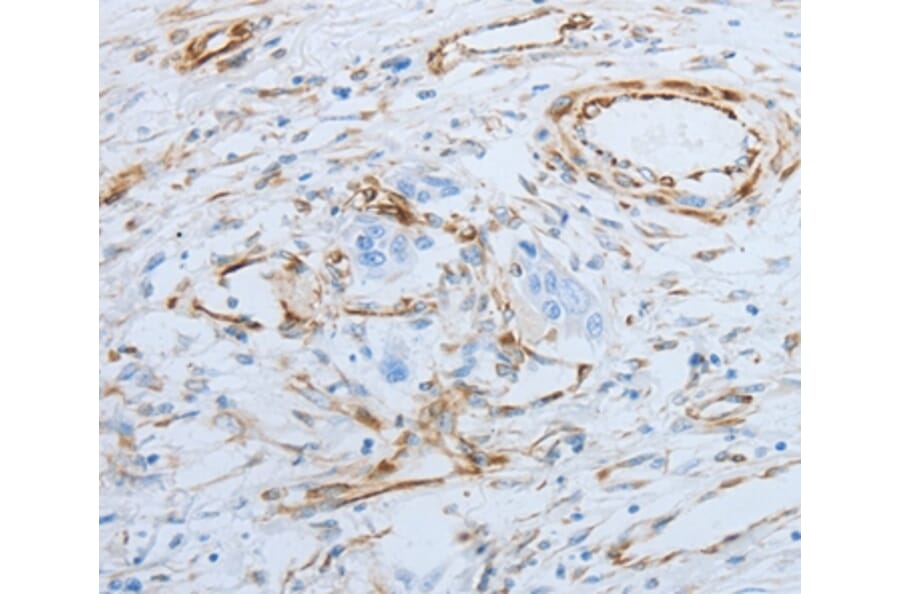 Immunohistochemistry - SPINT1 Antibody from Signalway Antibody (35764) - Antibodies.com