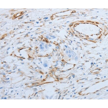 Immunohistochemistry - SPINT1 Antibody from Signalway Antibody (35764) - Antibodies.com