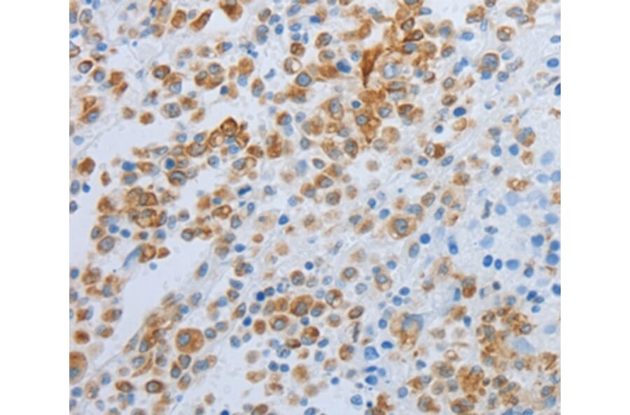 Immunohistochemistry - SPINT1 Antibody from Signalway Antibody (35764) - Antibodies.com