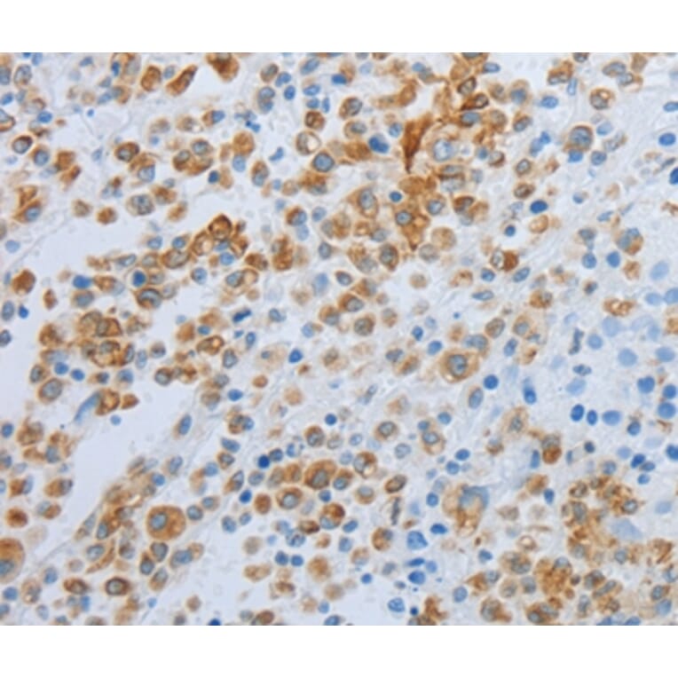 Immunohistochemistry - SPINT1 Antibody from Signalway Antibody (35764) - Antibodies.com