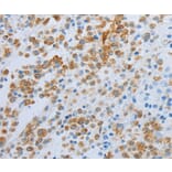 Immunohistochemistry - SPINT1 Antibody from Signalway Antibody (35764) - Antibodies.com