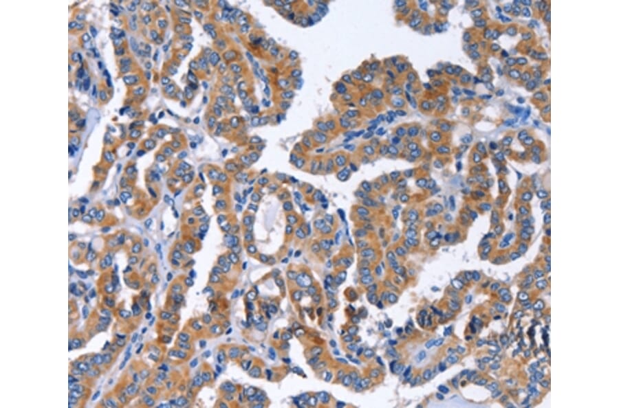 Immunohistochemistry - IGSF10 Antibody from Signalway Antibody (35777) - Antibodies.com
