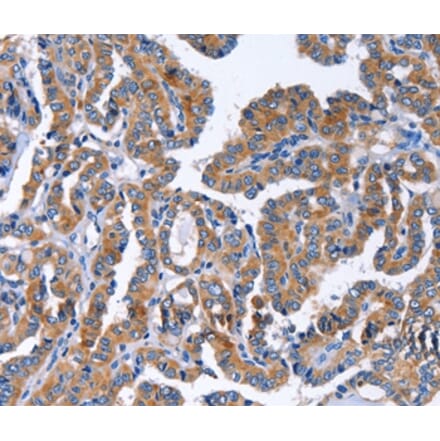 Immunohistochemistry - IGSF10 Antibody from Signalway Antibody (35777) - Antibodies.com