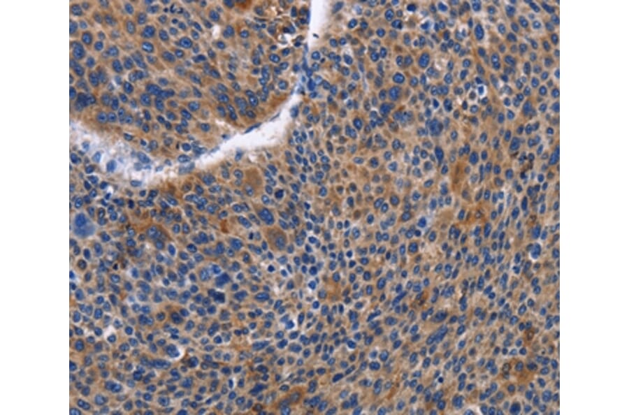 Immunohistochemistry - IGSF10 Antibody from Signalway Antibody (35777) - Antibodies.com