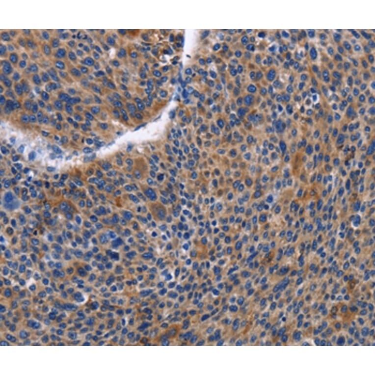 Immunohistochemistry - IGSF10 Antibody from Signalway Antibody (35777) - Antibodies.com