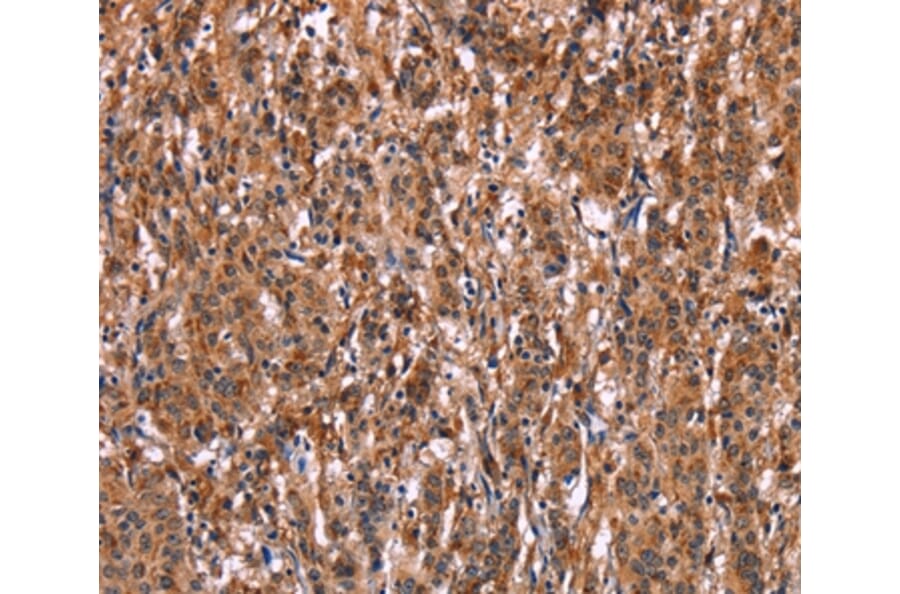 Immunohistochemistry - LILRB1 Antibody from Signalway Antibody (35790) - Antibodies.com