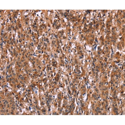 Immunohistochemistry - LILRB1 Antibody from Signalway Antibody (35790) - Antibodies.com