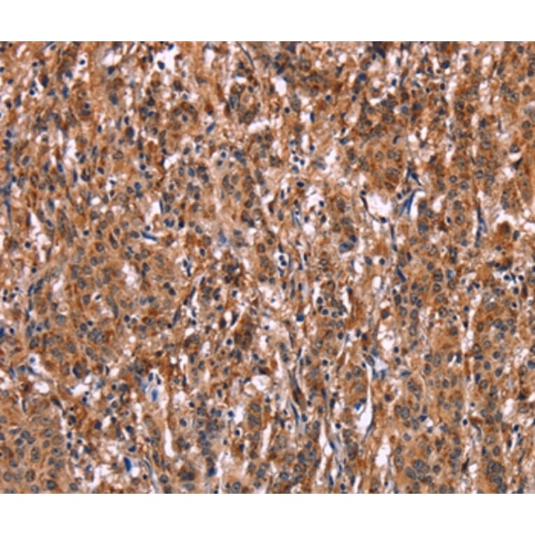 Immunohistochemistry - LILRB1 Antibody from Signalway Antibody (35790) - Antibodies.com