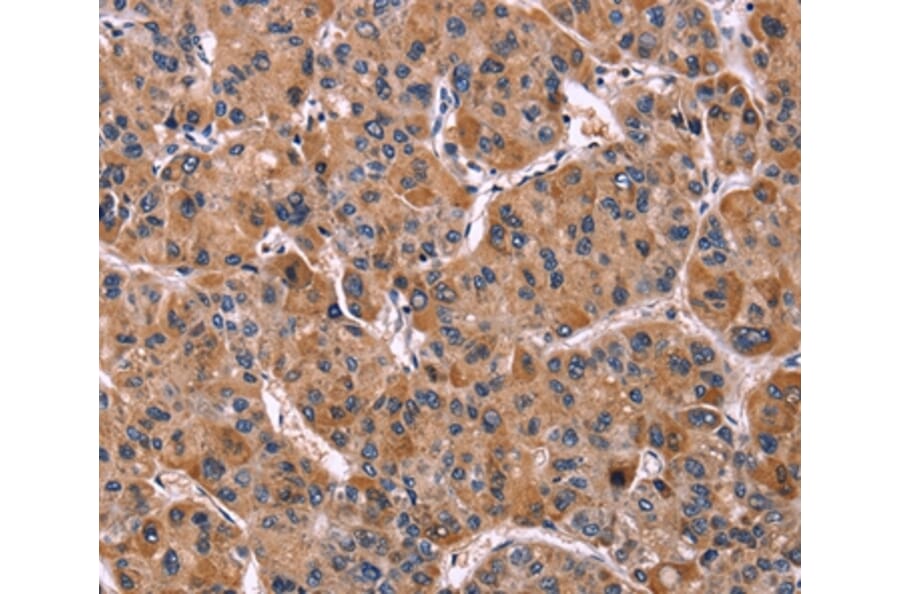 Immunohistochemistry - LILRB1 Antibody from Signalway Antibody (35790) - Antibodies.com