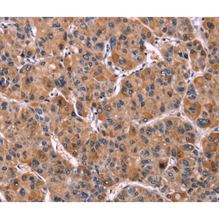 Immunohistochemistry - LILRB1 Antibody from Signalway Antibody (35790) - Antibodies.com