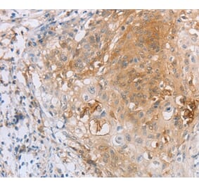 Immunohistochemistry - LILRB2 Antibody from Signalway Antibody (35791) - Antibodies.com