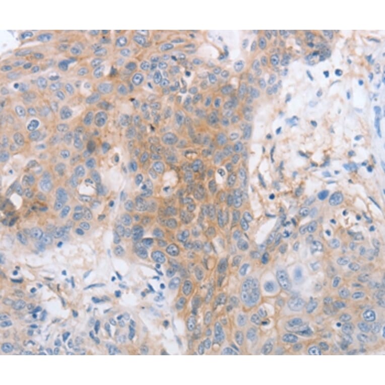 Immunohistochemistry - LILRB2 Antibody from Signalway Antibody (35791) - Antibodies.com