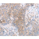 Immunohistochemistry - LILRB2 Antibody from Signalway Antibody (35791) - Antibodies.com