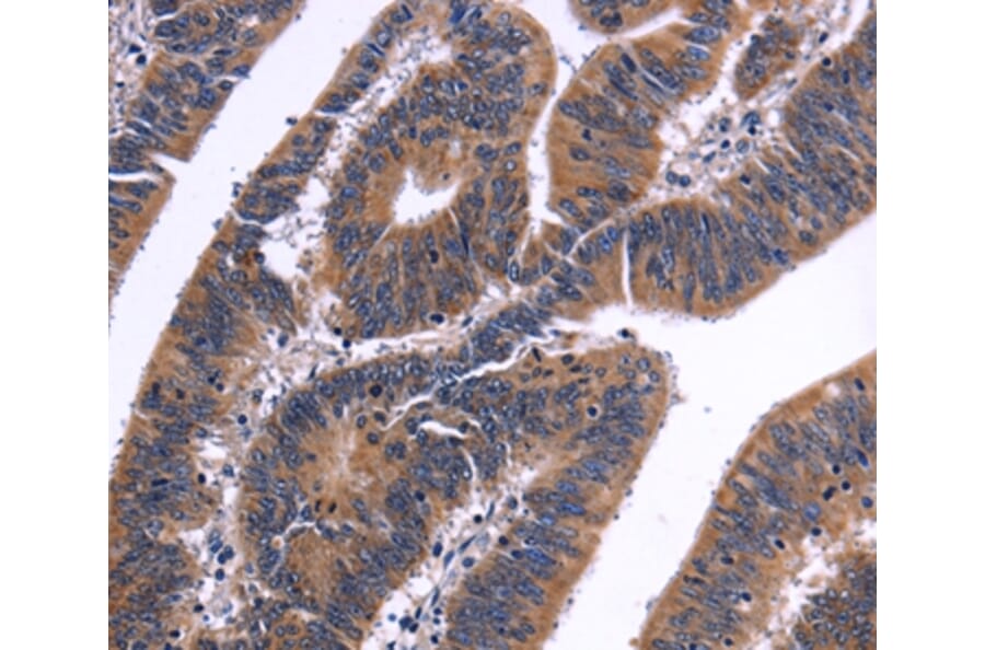 Immunohistochemistry - NFATC3 Antibody from Signalway Antibody (35836) - Antibodies.com