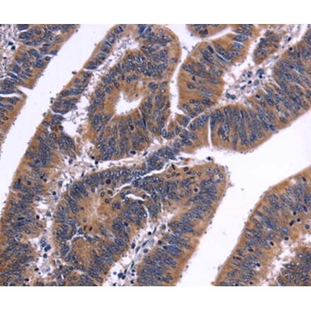 Immunohistochemistry - NFATC3 Antibody from Signalway Antibody (35836) - Antibodies.com