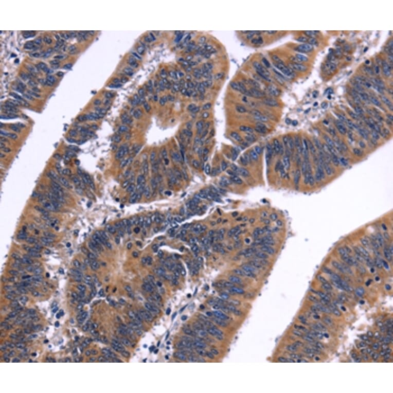 Immunohistochemistry - NFATC3 Antibody from Signalway Antibody (35836) - Antibodies.com