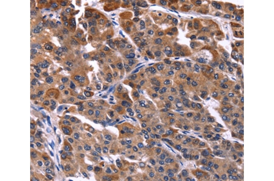 Immunohistochemistry - NFATC3 Antibody from Signalway Antibody (35836) - Antibodies.com