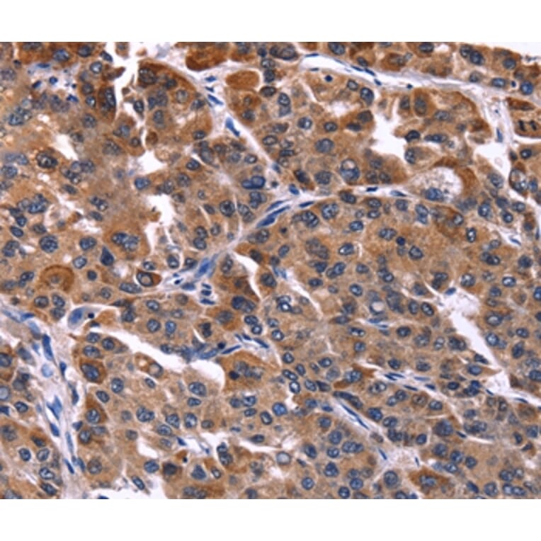 Immunohistochemistry - NFATC3 Antibody from Signalway Antibody (35836) - Antibodies.com