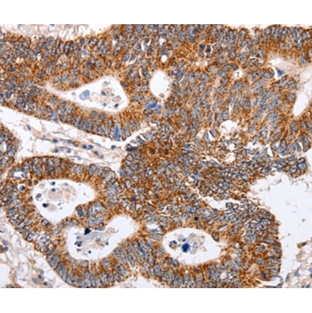 Immunohistochemistry - MAP2K5 Antibody from Signalway Antibody (35856) - Antibodies.com