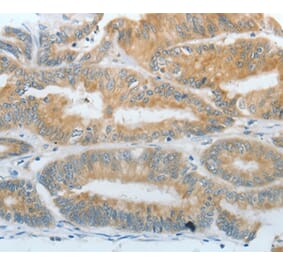 Immunohistochemistry - DNAJC3 Antibody from Signalway Antibody (35857) - Antibodies.com