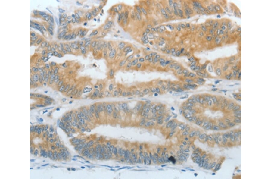 Immunohistochemistry - DNAJC3 Antibody from Signalway Antibody (35857) - Antibodies.com