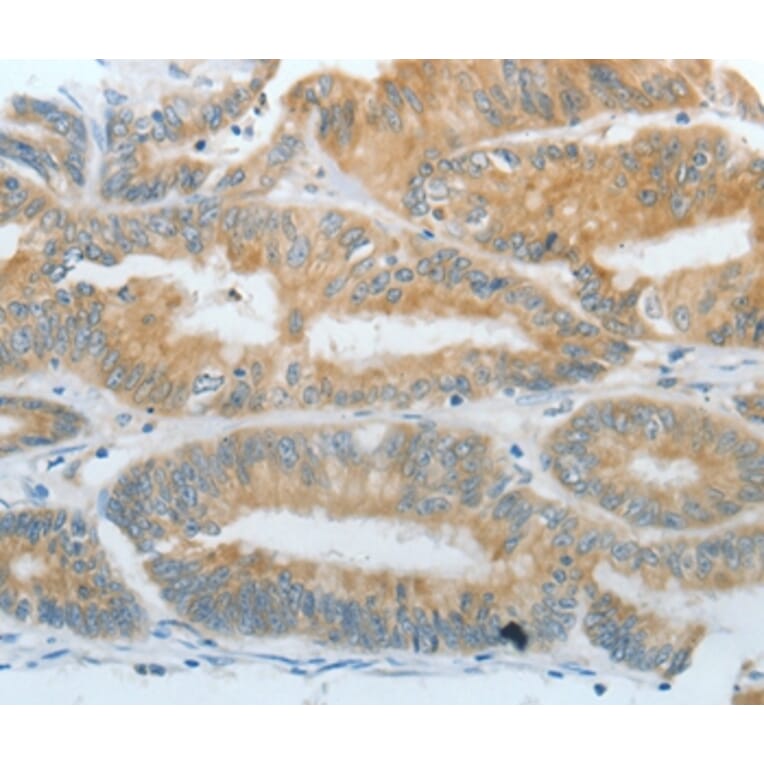 Immunohistochemistry - DNAJC3 Antibody from Signalway Antibody (35857) - Antibodies.com