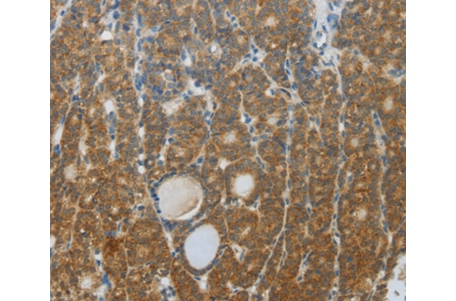 Immunohistochemistry - DNAJC3 Antibody from Signalway Antibody (35857) - Antibodies.com