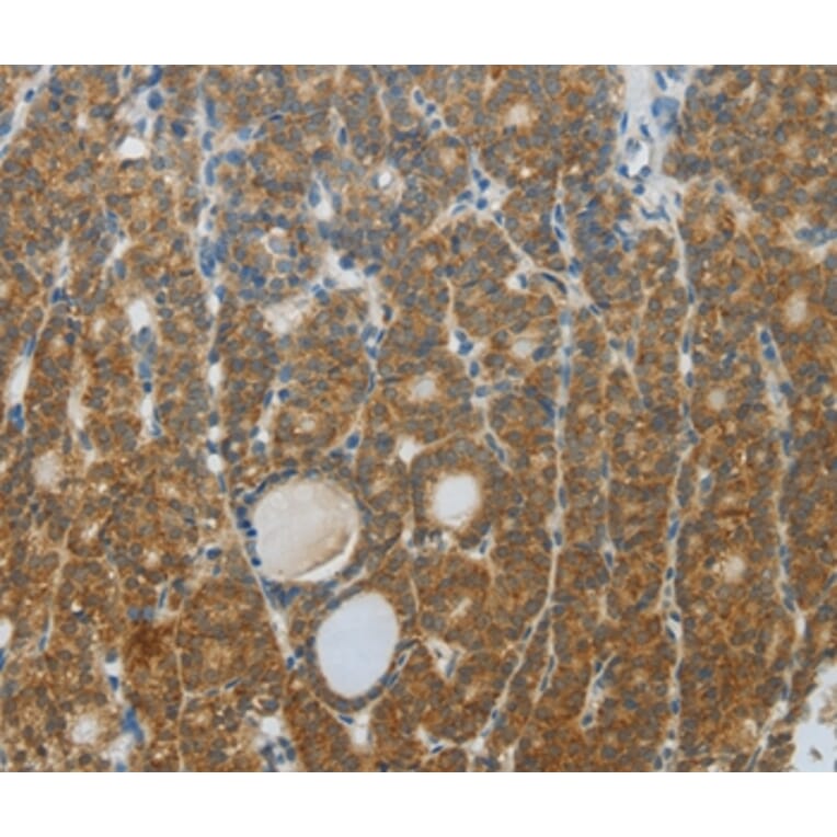 Immunohistochemistry - DNAJC3 Antibody from Signalway Antibody (35857) - Antibodies.com