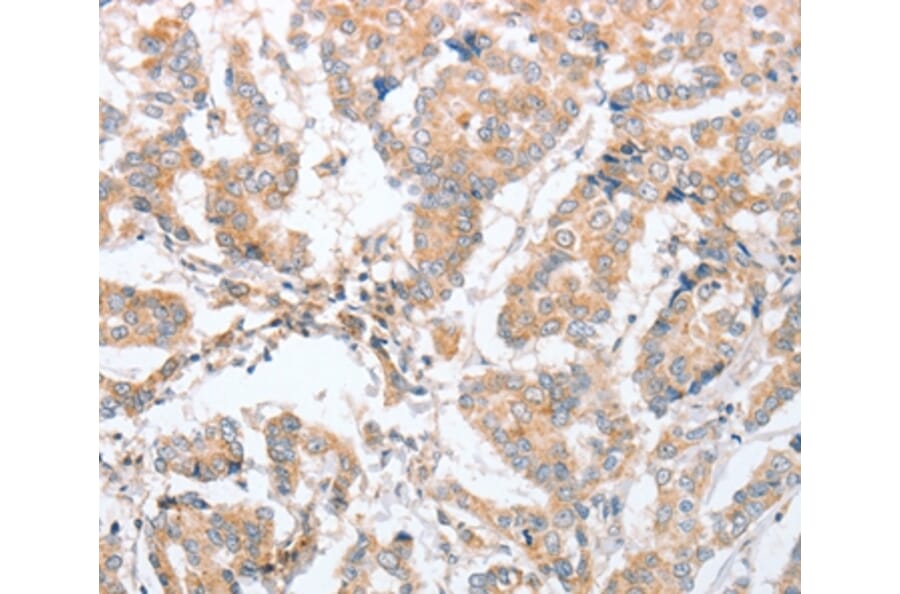 Immunohistochemistry - PARD6A Antibody from Signalway Antibody (35868) - Antibodies.com
