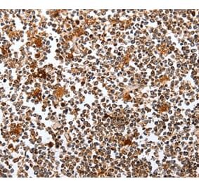 Immunohistochemistry - PIK3R1 Antibody from Signalway Antibody (35878) - Antibodies.com