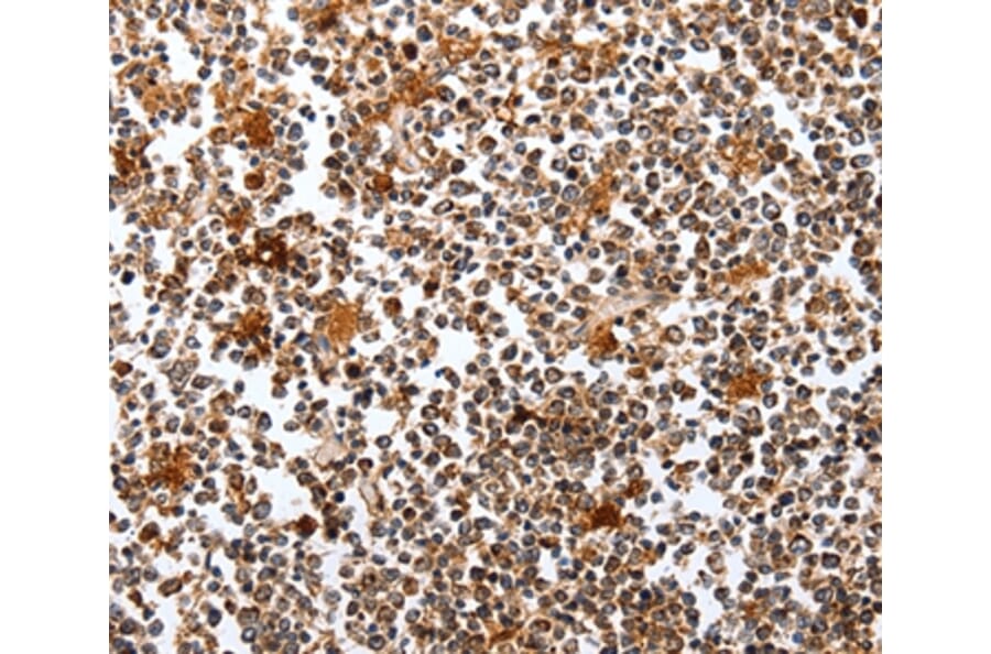 Immunohistochemistry - PIK3R1 Antibody from Signalway Antibody (35878) - Antibodies.com