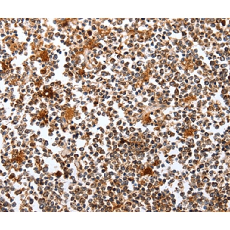 Immunohistochemistry - PIK3R1 Antibody from Signalway Antibody (35878) - Antibodies.com