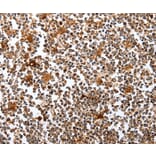 Immunohistochemistry - PIK3R1 Antibody from Signalway Antibody (35878) - Antibodies.com