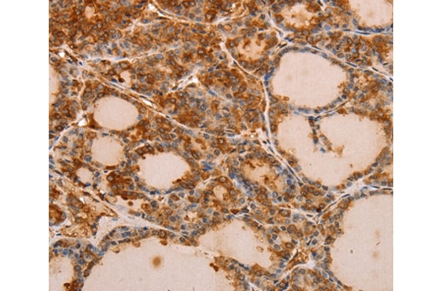 Immunohistochemistry - PIK3R1 Antibody from Signalway Antibody (35878) - Antibodies.com