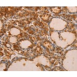 Immunohistochemistry - PIK3R1 Antibody from Signalway Antibody (35878) - Antibodies.com