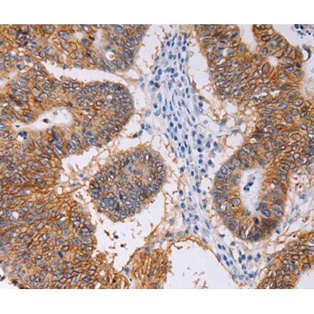 Immunohistochemistry - PIWIL1 Antibody from Signalway Antibody (35880) - Antibodies.com