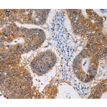 Immunohistochemistry - PIWIL1 Antibody from Signalway Antibody (35880) - Antibodies.com