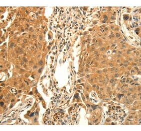 Immunohistochemistry - PRKACG Antibody from Signalway Antibody (35881) - Antibodies.com