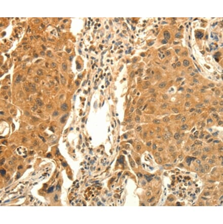 Immunohistochemistry - PRKACG Antibody from Signalway Antibody (35881) - Antibodies.com