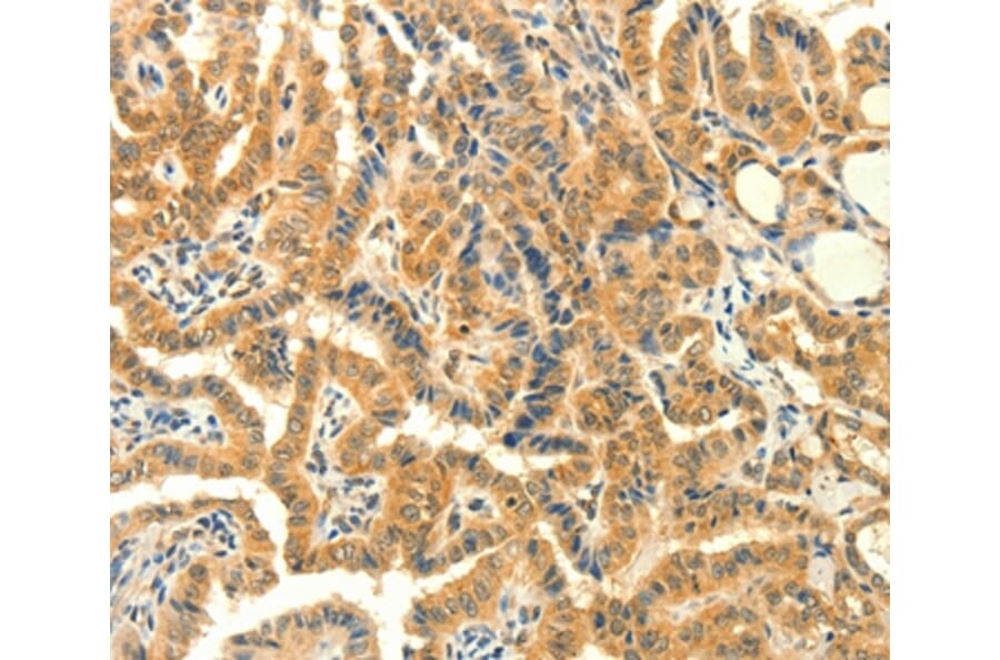 Immunohistochemistry - PRKACG Antibody from Signalway Antibody (35881) - Antibodies.com