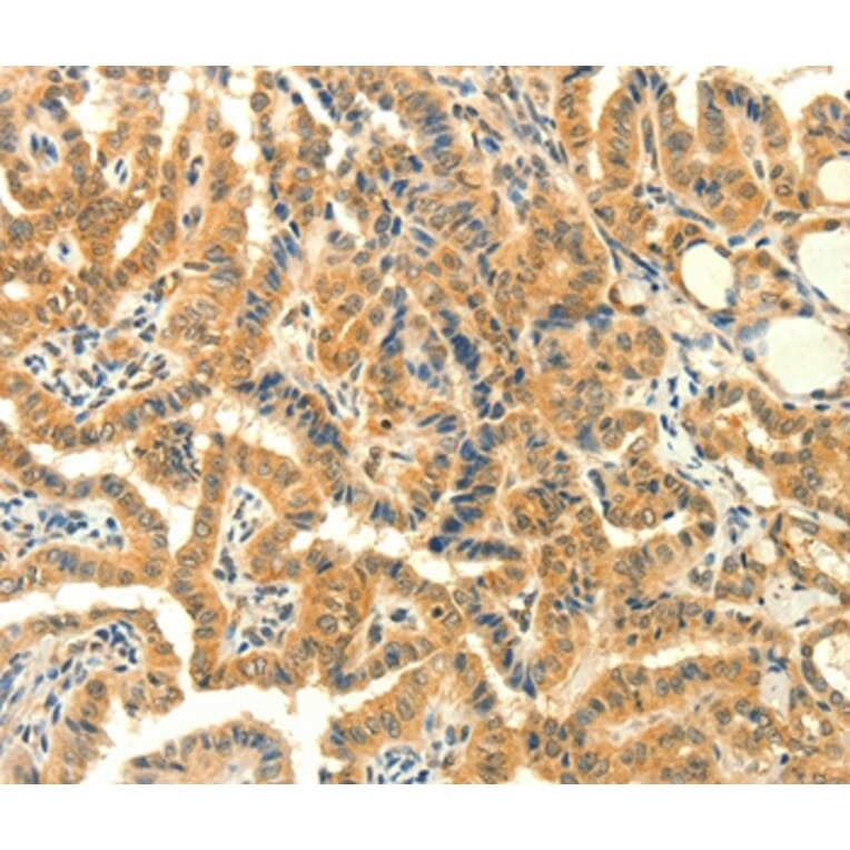 Immunohistochemistry - PRKACG Antibody from Signalway Antibody (35881) - Antibodies.com