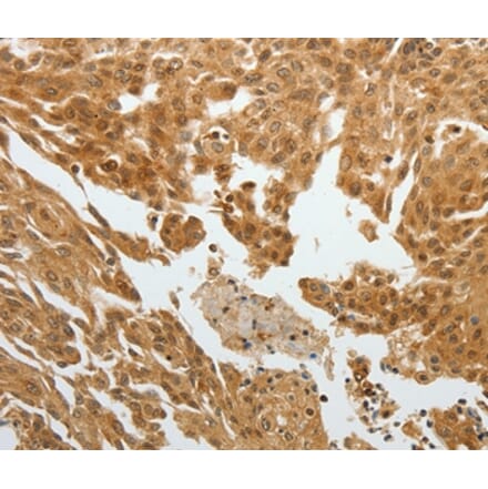 Immunohistochemistry - RETNLB Antibody from Signalway Antibody (35905) - Antibodies.com