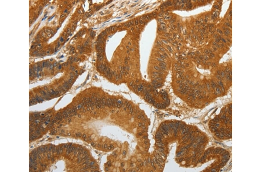 Immunohistochemistry - RETNLB Antibody from Signalway Antibody (35905) - Antibodies.com