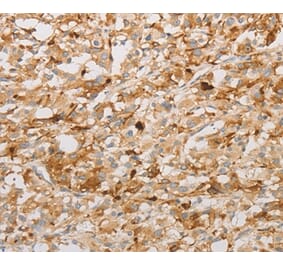 Immunohistochemistry - S100A1 Antibody from Signalway Antibody (35908) - Antibodies.com