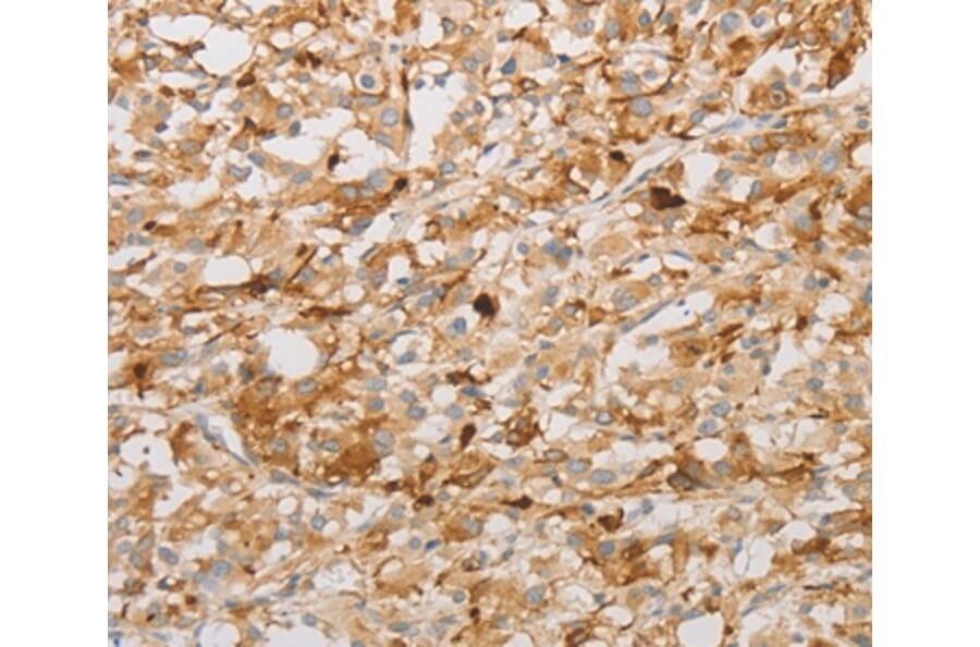 Immunohistochemistry - S100A1 Antibody from Signalway Antibody (35908) - Antibodies.com