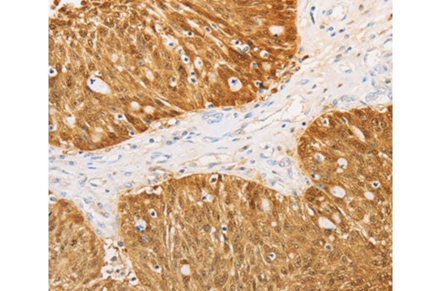 Immunohistochemistry - S100A1 Antibody from Signalway Antibody (35908) - Antibodies.com